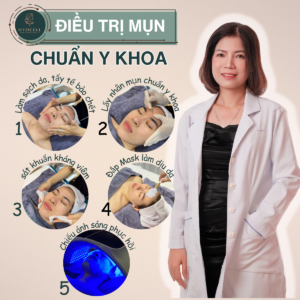 điều trị mụn chuẩn y khoa tại Hyocell