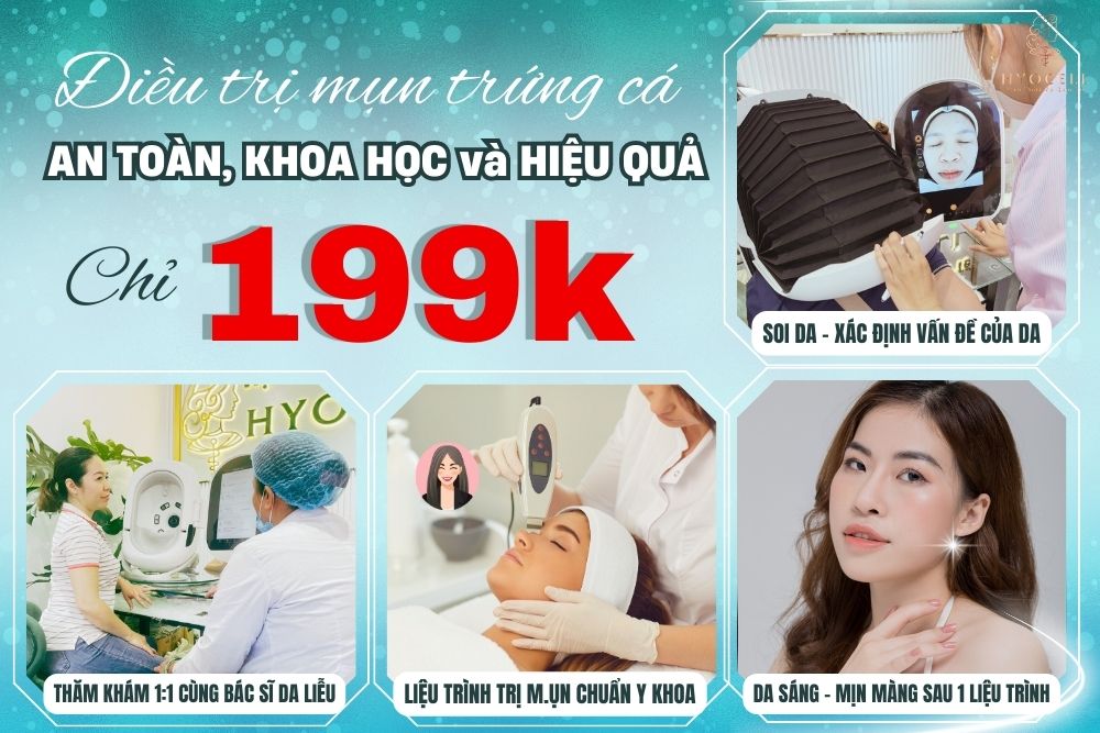 Điều trị mụn trứng cá mụn đầu đen