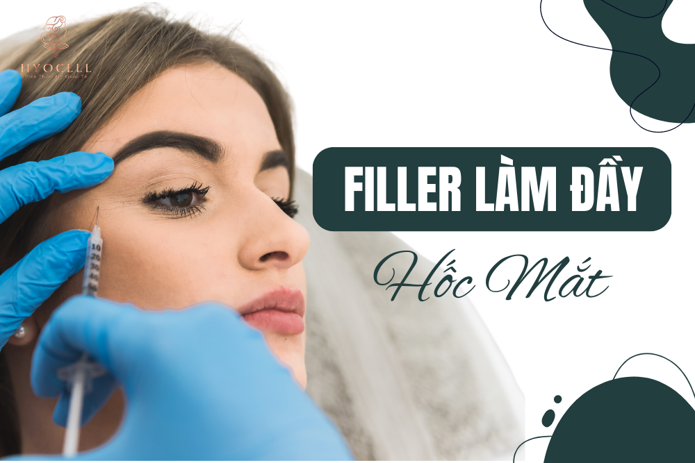 filler Làm đầy hốc mắt