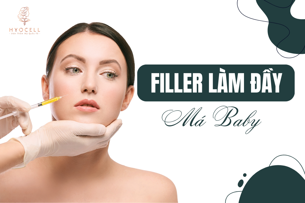 filler Làm đầy má baby