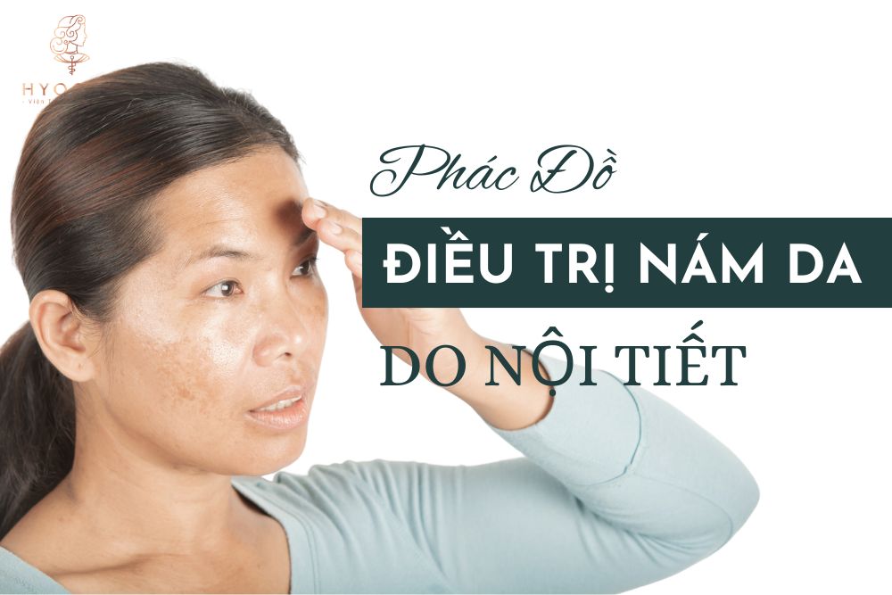 Phác đồ điều trị nám nội tiết