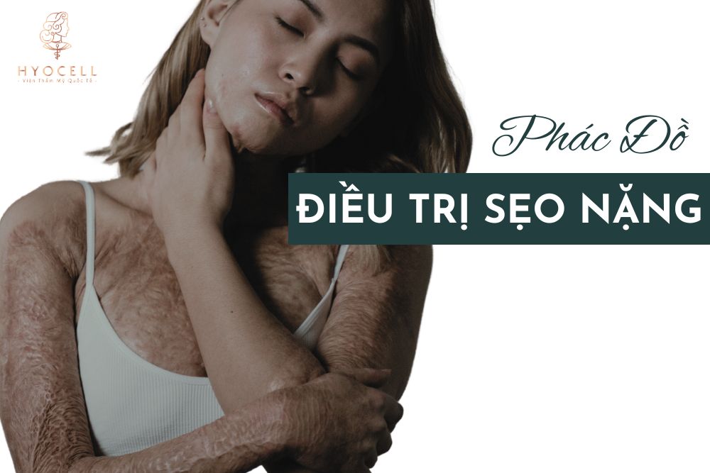 Phác đồ điều trị sẹo nặng