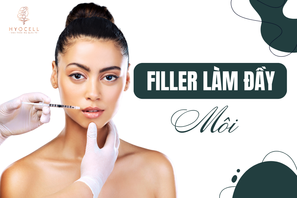 Tiêm filler làm đầy môi