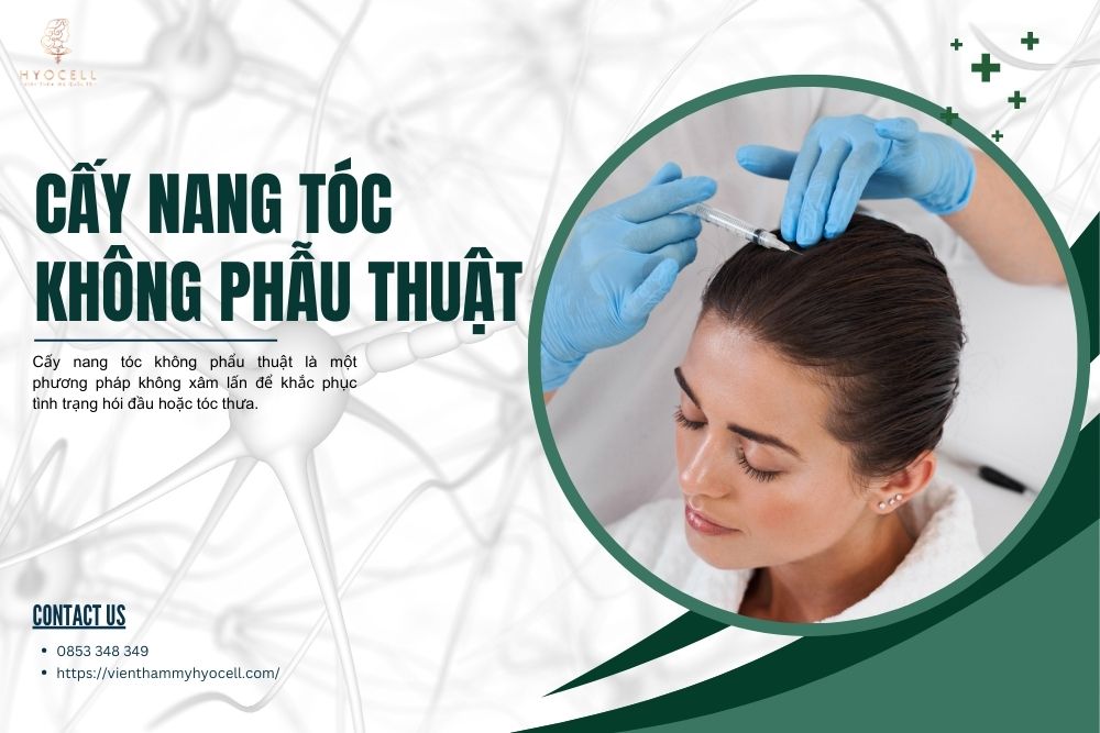 cấy nang tóc không phẫu thuật