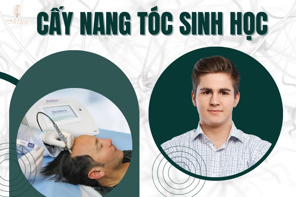 cấy nang tóc sinh học