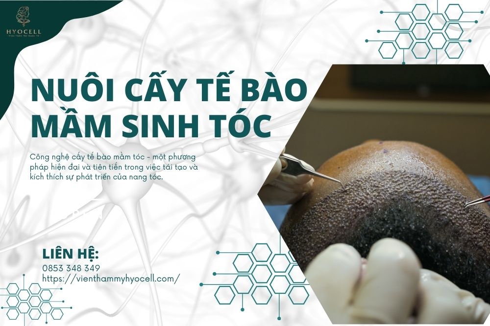 cấy tế bào mầm tóc