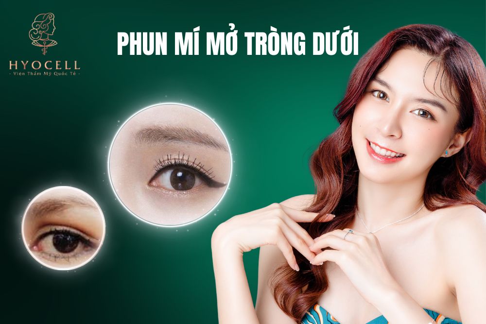 Phun mí mở tròng dưới